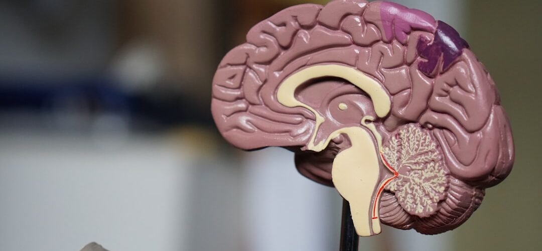 Photo Brain scan
